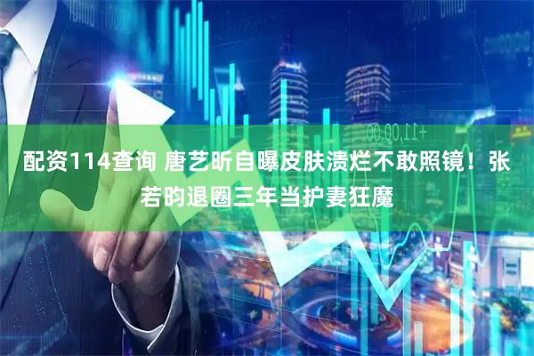 配资114查询 唐艺昕自曝皮肤溃烂不敢照镜！张若昀退圈三年当护妻狂魔